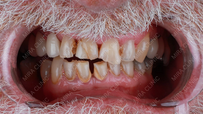 complexity of the case 